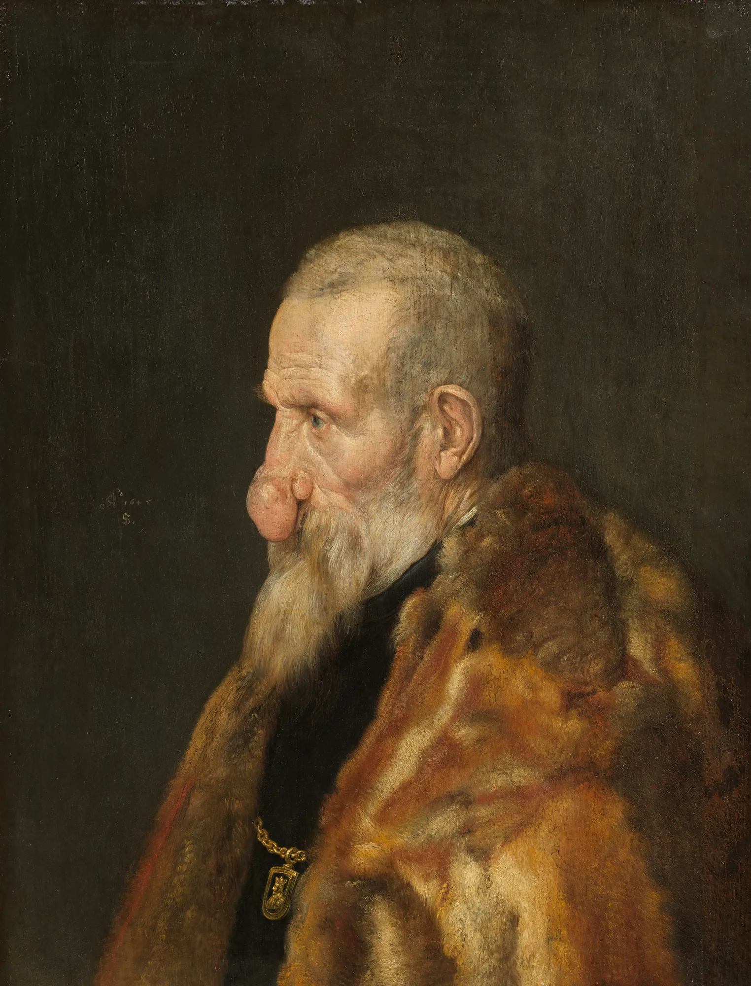 Old Man with a Growth on his Nose Old Man with a Growth on his Nose by Monogrammist IS. A profile portrait of an elderly man with a long white beard and a distinctive growth on his nose, draped in a rich fur-lined cloak.